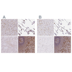 PYCARD Polyclonal Antibody