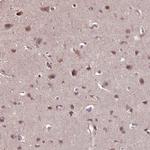 WDR17 Antibody in Immunohistochemistry (Paraffin) (IHC (P))