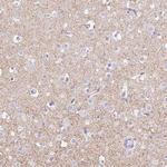 Orexin Receptor 2 Polyclonal Antibody