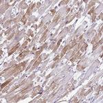 ST8SIA2 Antibody in Immunohistochemistry (Paraffin) (IHC (P))