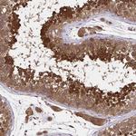 UBE2M Antibody in Immunohistochemistry (Paraffin) (IHC (P))