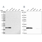 UBE2M Antibody in Western Blot (WB)