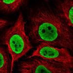 NONO Polyclonal Antibody