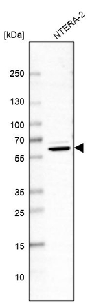 NONO Antibody in Western Blot (WB)