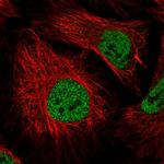 ZNF197 Polyclonal Antibody