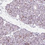 ZNF197 Antibody in Immunohistochemistry (Paraffin) (IHC (P))