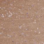 FLRT1 Antibody in Immunohistochemistry (Paraffin) (IHC (P))