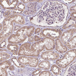 FLRT1 Antibody in Immunohistochemistry (Paraffin) (IHC (P))
