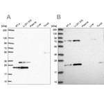 eIF3k Antibody in Western Blot (WB)
