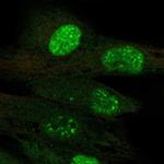 TERT Polyclonal Antibody