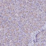 Clathrin Light Chain A Polyclonal Antibody