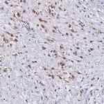 Clathrin Light Chain A Antibody in Immunohistochemistry (Paraffin) (IHC (P))