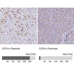 Clathrin Light Chain A Antibody