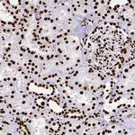 SFPQ Antibody in Immunohistochemistry (Paraffin) (IHC (P))