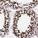 SFPQ Antibody in Immunohistochemistry (Paraffin) (IHC (P))