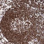 SFPQ Antibody in Immunohistochemistry (Paraffin) (IHC (P))