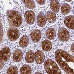 BCAS1 Antibody in Immunohistochemistry (Paraffin) (IHC (P))