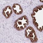 BCAS1 Antibody in Immunohistochemistry (Paraffin) (IHC (P))