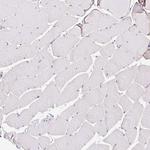 BCAS1 Antibody in Immunohistochemistry (Paraffin) (IHC (P))