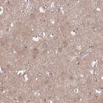 Talin 2 Antibody in Immunohistochemistry (Paraffin) (IHC (P))