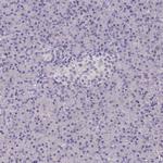 Talin 2 Polyclonal Antibody