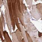 HSP20 Antibody in Immunohistochemistry (Paraffin) (IHC (P))