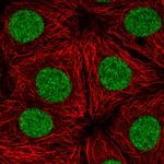 TTF1 Polyclonal Antibody