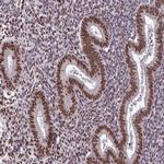 TTF1 Antibody in Immunohistochemistry (Paraffin) (IHC (P))