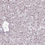 TTF1 Antibody in Immunohistochemistry (Paraffin) (IHC (P))