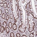 TTF1 Antibody in Immunohistochemistry (Paraffin) (IHC (P))