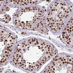TTF1 Antibody in Immunohistochemistry (Paraffin) (IHC (P))