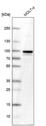 TTF1 Antibody in Western Blot (WB)