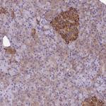 TRIM17 Antibody in Immunohistochemistry (Paraffin) (IHC (P))