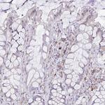 CD178 Antibody in Immunohistochemistry (Paraffin) (IHC (P))