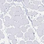 CD178 Antibody in Immunohistochemistry (Paraffin) (IHC (P))