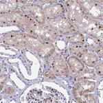 RBL1 Antibody in Immunohistochemistry (Paraffin) (IHC (P))