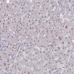 RBL1 Antibody in Immunohistochemistry (Paraffin) (IHC (P))