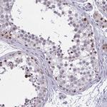 RBL1 Antibody in Immunohistochemistry (Paraffin) (IHC (P))