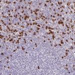 ADCK1 Antibody in Immunohistochemistry (Paraffin) (IHC (P))