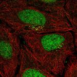 PPP1R1C Polyclonal Antibody