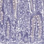 MYLPF Polyclonal Antibody