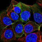 TROP2 Antibody in Immunocytochemistry (ICC/IF)