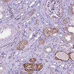 TROP2 Antibody in Immunohistochemistry (Paraffin) (IHC (P))