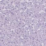 TROP2 Antibody in Immunohistochemistry (Paraffin) (IHC (P))