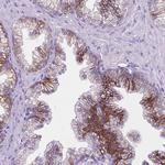 TROP2 Antibody in Immunohistochemistry (Paraffin) (IHC (P))