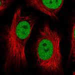 ATF1 Polyclonal Antibody