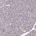ATF1 Antibody in Immunohistochemistry (Paraffin) (IHC (P))