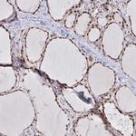 ATF1 Antibody in Immunohistochemistry (Paraffin) (IHC (P))