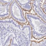 SGLT1 Antibody in Immunohistochemistry (Paraffin) (IHC (P))
