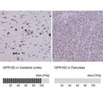GPR162 Antibody